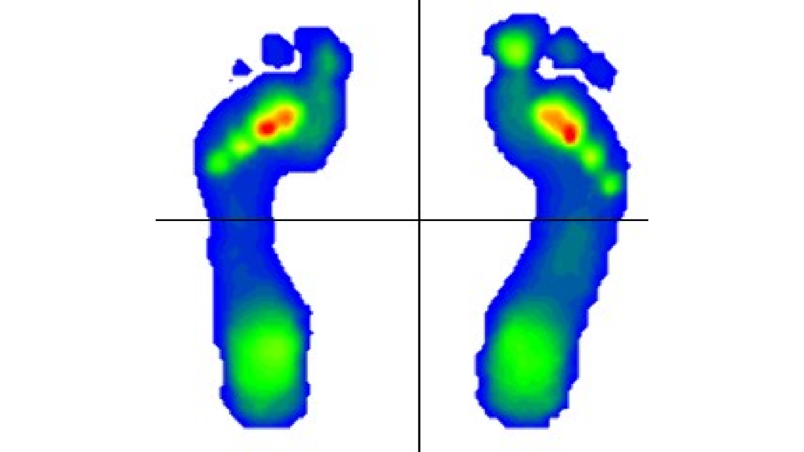 Eine visuelle Darstellung der Druckmessung